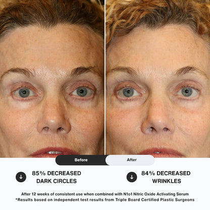 Age-Defiance Eye Cream - Day & Night Moisturizer with Nitric Oxide, Hyaluronic Acid, Complex Peptides, Ceramides - Hydrating Eye Cream for Dark Circles, Wrinkles, Fine Lines, Puffiness - 0.5 oz.