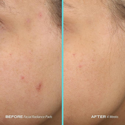 First aid beauty facial radiance