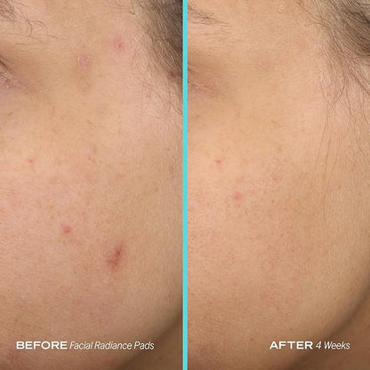 First aid beauty facial radiance