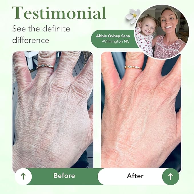 Theraplex Skin Barrier Balm- Barrier