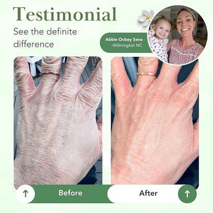 Theraplex Skin Barrier Balm- Barrier