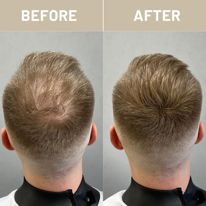 VOLLUCK Hair Fibers for Thinning Hair, Instant Coverage Hair Building Fibers for Women and men, Natural Hair Powder for Conceal Hair Loss 28 g (Light Blonde)