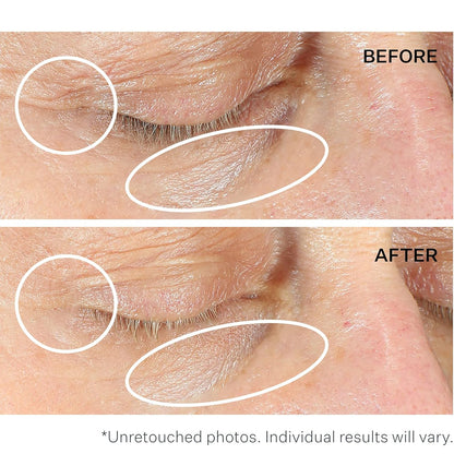 StriVectin Anti-Wrinkle Intensive Eye Cream Concentrate for Wrinkles PLUS, Targets Crow's Feet, Firmness, Puffiness & Dark Circles, 1 Fl oz