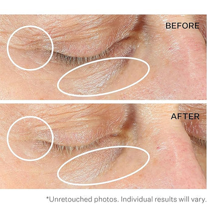 Strivectin anti-wrinkle intensive eye cream