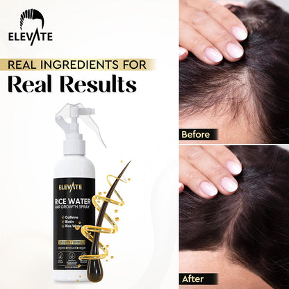 Elevate Rice Water Hair Growth Spray - Infused with Biotin, Caffeine & Aloe Vera for Thicker, Longer, Softer Hair - Fermented Leave In Mist for Thinning, Damaged Hair - Vegan & Non-Greasy