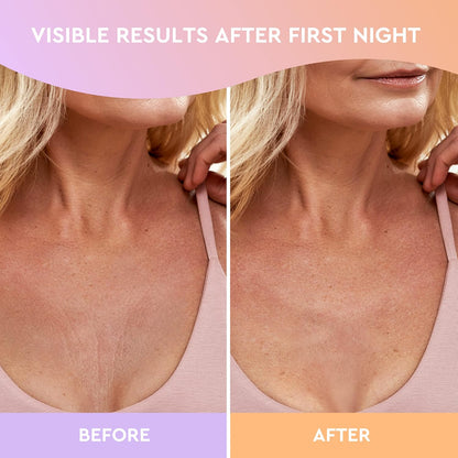 CLEVERFY Silicone Chest Wrinkle Pads Sleeping Reusable (2 Pack V-shape) - Decollete Anti Wrinkle Chest Pads - Silicone Patches for Wrinkles - Anti Wrinkle Patches for Decollete Wrinkle Prevention