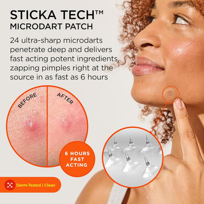 ZitSticka Killa Pimple Patches for Face - World's Most Potent Pimple Patch with Fast-Acting Microdarts - Starts Working within 6 Hours for Deep, Early-Stage Zits - Regular 8 Count with Cleana Swab