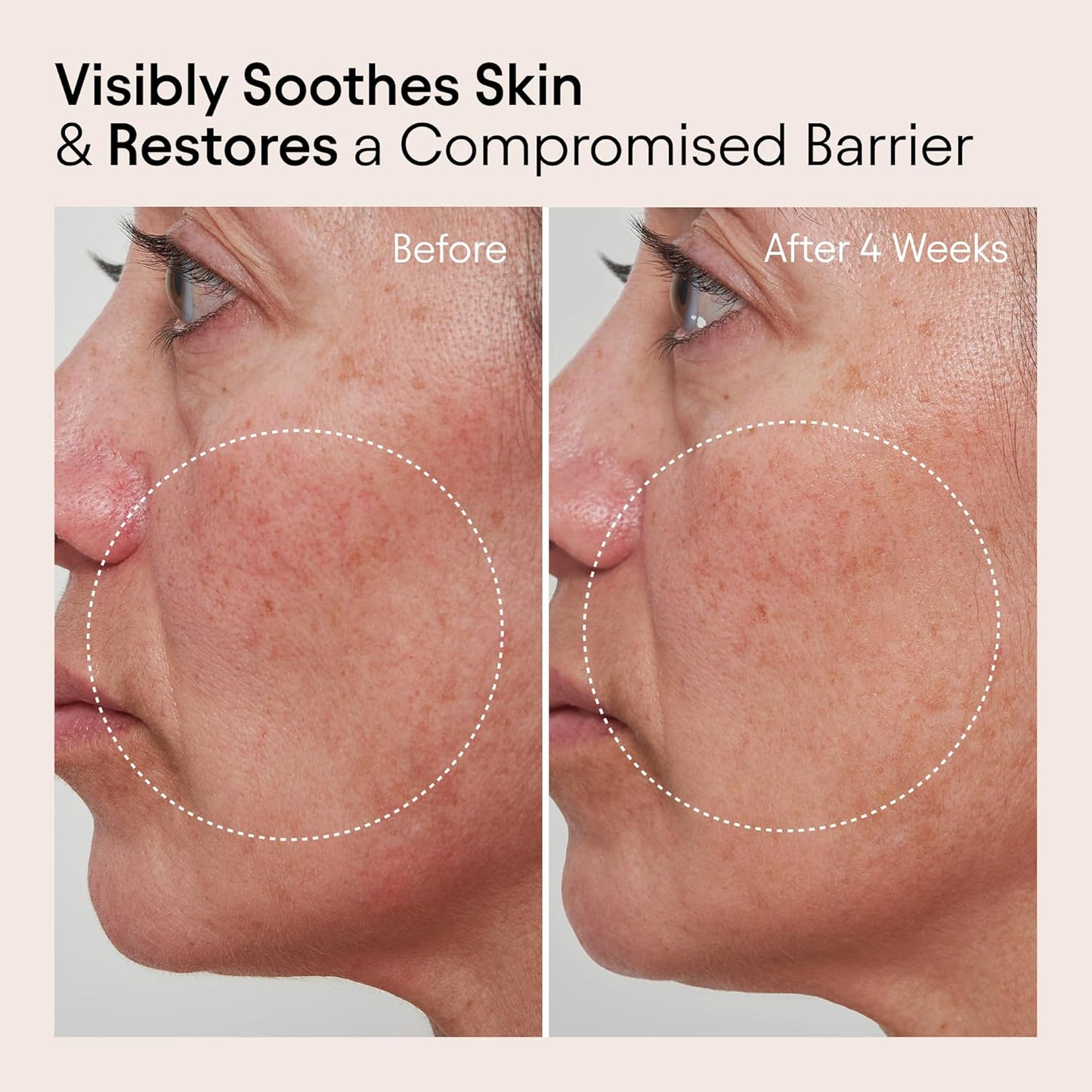 Alpyn Super Peptide & Ghostberry Moisturizer for Eczema, Barrier & Wrinkle Repair | Calm & Soothe Against Redness & Irritation | 1.7 oz / 50 ml