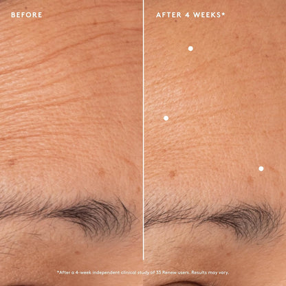 Naked & Thriving The Advanced Renewal Routine | Restore Ultra-Rich Night Cream (50g) + Refresh Gentle Enzyme Cleanser (120ml) + Renew Resurfacing Night Serum (30ml) (Set of 3)