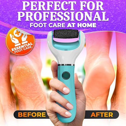 Electric foot callus remover -
