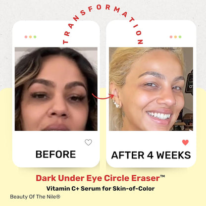 Dark Under Eye Circle Eraser™ Vitamin C+ Serum for Skin-of-Color, Dark Circle Puffiness Wrinkle Hyaluronic Acid Superoxide D, Beauty of the Nile® 1 Oz