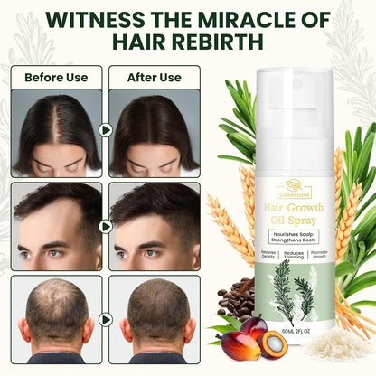 Hair Growth Oil Spray with Rosemary Batana Oil Biotin Caffeine for Hair Growth Spray Anti Hair Loss Repair of Sparse Hair for Women Men 2 Bottles 2 FL OZ Each