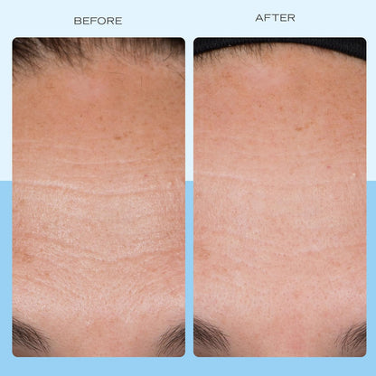 First Aid Beauty - Firming Collagen Cream with Peptides & Niacinamide, Ultra-Rich Plumping Moisturizer, Hydrates & Visibly Firms, Non-Comedogenic, Safe for Sensitive Skin, 3.5 oz