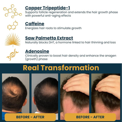 Copper Peptide Serum for Hair Growth - Caffeine, Niacinamide, Rosemary Oil, Saw Palmetto Hair Density Serum, Topical Tripeptide Scalp Care for Hair Thinning, Women & Men 1 fl oz
