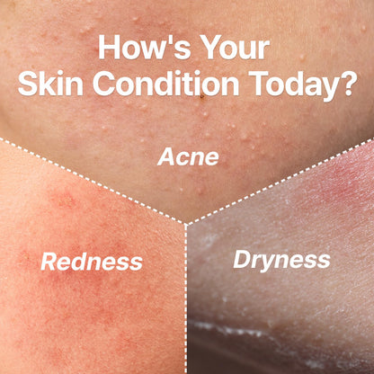 Green Barley Light Cleansing Oil, Hydrating Daily Cleanser for Sensitive Skin, Blackhead Remover, Korean Vegan Skin Care, 6.93 Fl Oz