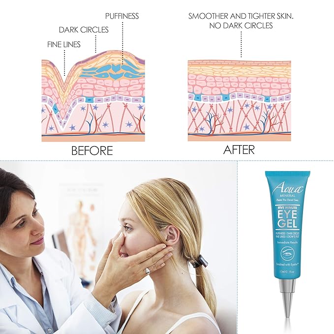 Puffy eye gel instant results
