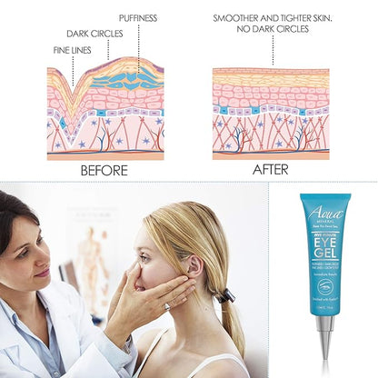 Puffy eye gel instant results