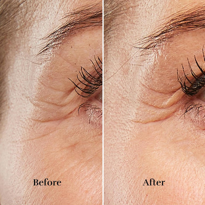 Silk’n Anti-Aging Device - Titan Mini - Wrinkle Reduction and Skin Tightening - Rejuvenates Skin on Smaller Face Areas - Cordless Use - Skin Care Device with LED - Unisex Hygiene and Personal Care