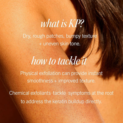 First Aid Beauty - KP Bump Eraser Body Scrub with 10% AHA, Keratosis Pilaris Skin Exfoliator with Glycolic and Lactic acids, Helps Reduce Chicken Bumps, Safe for Sensitive Skin, 2 oz