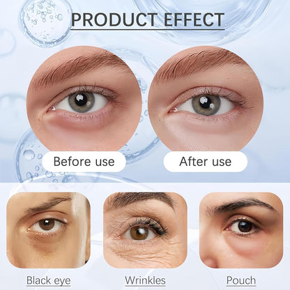 EYES Perfection Tightener - Instant Firming Primer with Hyaluronic Acid & Vitamin E, Easy-Wear Formula for Ultimate Lift & Smooth Finish, Hydrates & Refreshes Tired 0.67oz (1pc)