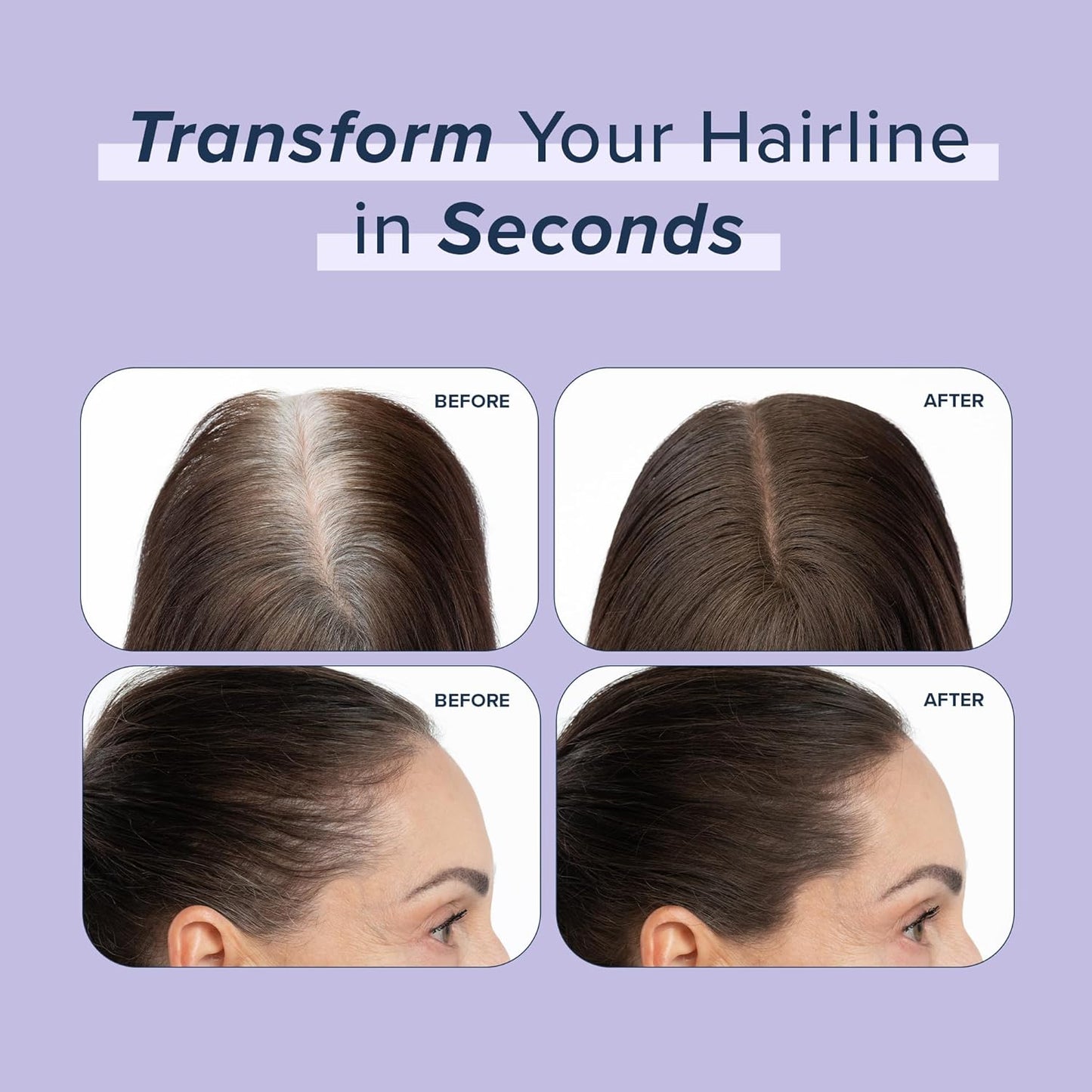 TRUHAIR Root & Scalp Cover Up Pressed Powder Compact, Waterproof Hair Coverage for Gray Roots and Thinning Areas, 0.35 Oz (Red)