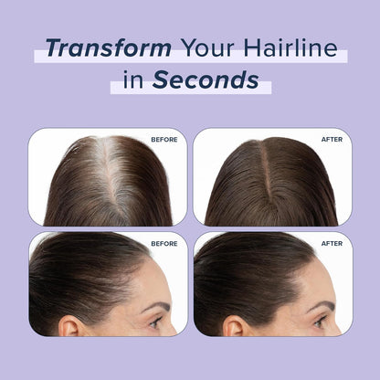 TRUHAIR Root & Scalp Cover Up Pressed Powder Compact, Waterproof, Weightless Hair Coverage & Bald Spot Concealing, Root Touch Up Hair Color for Gray Coverage & Thinning Areas, 0.35 Oz (White)