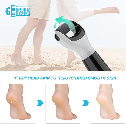 ChargeWorx Groom Essentials Cordless Callus Remover for Feet, Electric Pedicure Tool with Spinning Pumice Stone Head, Portable Foot Scrubber and Heel Scraper, Includes 2 Replacement Pumice Heads