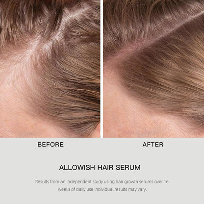 Hair Growth Serums 95 ml - Rosemary Hair Thickening Serum with Biotin, Caffeine for Hair Thinning & Shedding – Promotes Healthy Scalp, Fuller, Nourish, Strengthens Roots