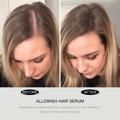 Hair Growth Serums 95 ml - Rosemary Hair Thickening Serum with Biotin, Caffeine for Hair Thinning & Shedding – Promotes Healthy Scalp, Fuller, Nourish, Strengthens Roots