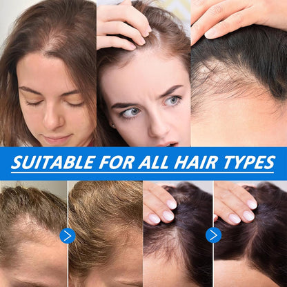 Ovela Hair Ampoule Serum, Scalpy Hair Growth Serum for Hair Loss & Thinning | Hair Growth Serum Women & Men w/Salicylic Acid, Menthol, Dexpanthenol | Non-Greasy, Lightweight (1 PCS)