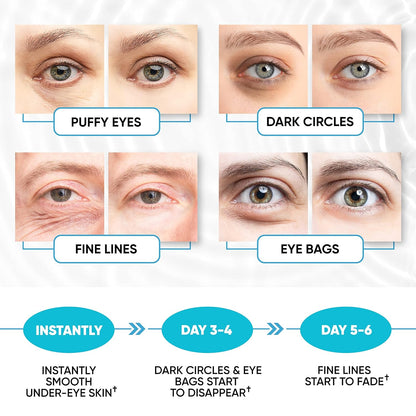 Under Eye Patches for Puffy Eyes, Dark Circles, Dull Skin - Natural Moisturizing Support - Help with Wrinkles and Fine Lines - Under Eye Mask with Hyaluronic Acid, Collagen, Caffeine - 30 Pairs