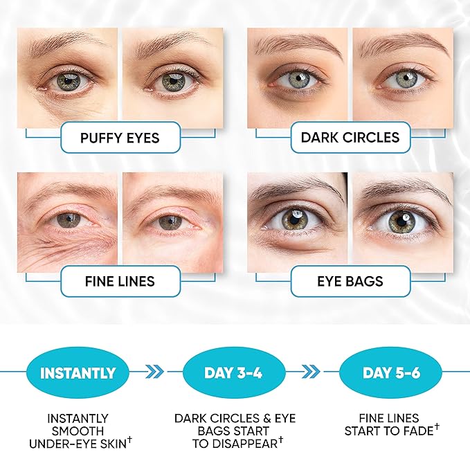 Under eye patches for puffy