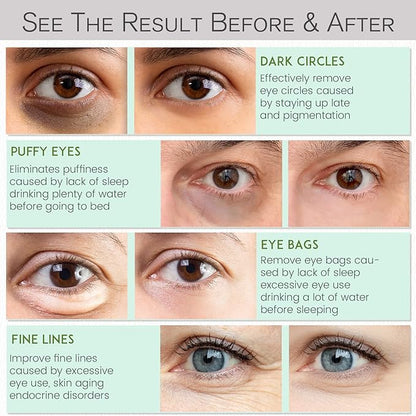 Under eye patches for dark