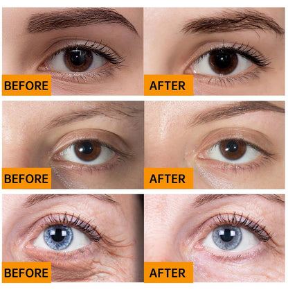 Caffeine Solution 5% + EGCG, Caffeine Eye Serum For Face, 30 ML/ 2 PCS Moisturizing Under Eye Solution For Reduces Dark Circles & Puffiness.