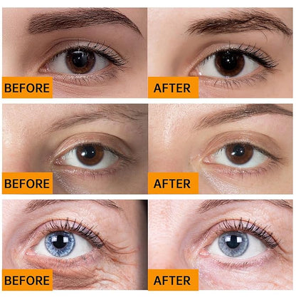 Caffeine solution 5% + egcg,