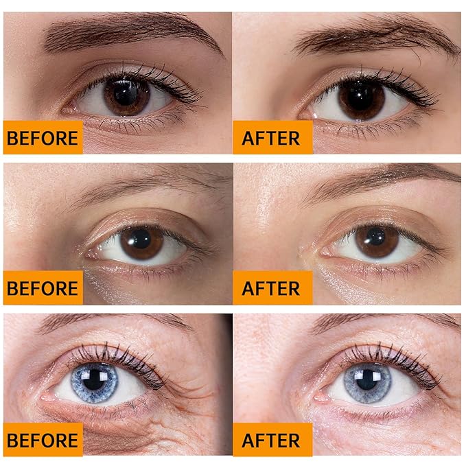 Caffeine solution 5% + egcg,