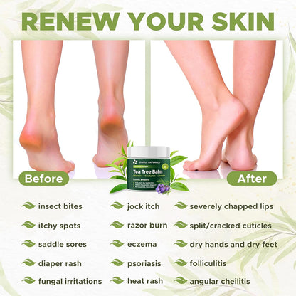OWELL NATURALS Tea Tree Balm Oil with Vitamin E for Itchy, Dry, Flaky and Cracked Skin, Athletes Foot, Hands, Rashes, Bee Stings, Splinters, Poison Ivy, Insect Bites, Cuts and Burns, (2 Pack)