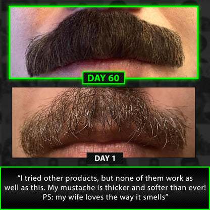 Beard Growth Kit w/ 2X Thickening Biotin Beard Balm for Men & Mustache Wax + GROW Maximum Strength Biotin 11-in-1 Hair Growth Shampoo and Conditioner for Men - Formulated in the USA