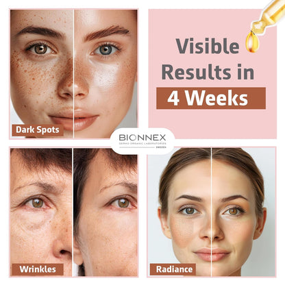 The nordea - 5% Caffeine Serum Angelica - Anti-Aging Eye Serum for Dark Circles, Puffiness and Wrinkles - Caffeine Eye Serum Natural and Vegan - 30 ml (5% Caffeine Skin Serum)