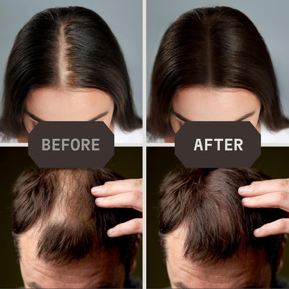 Striking Viking Hair Fibers for Thinning Hair - 28 g, Medium Brown - Bald Spot Cover Up & Sweat-Proof Thickening Powder