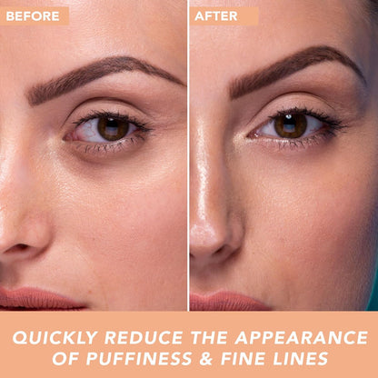 Eye Cream - USA Made with Natural & Organic Ingredients, Cooling Eye Gel & Under Eye Brightener, Dark Circles Under Eye Treatment with Hyaluronic Acid & Glycerin, Reduces Puffiness & Under Eye Bags