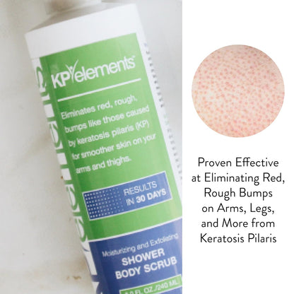 KP Elements Body Scrub (8 fl oz) | Keratosis Pilaris Treatment | Exfoliating Body Scrub and Body Moisturizer for Dry Skin | Helps Reduce Red Bumps | Body Skin Care Product for Men and Women