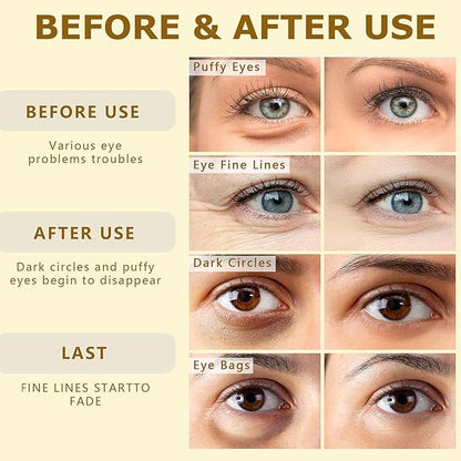 24k gold vitality-fill eye patches