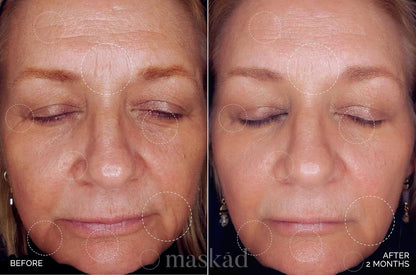 MASKĀD® Advanced Anti-Aging Multi-Peptide Enriched Facial Serum, Peptide Serum to Support Skin Appearance, Fine Lines, & Hydration, Collagen-Focused Care, Clean, Gentle Skin Care, Extra Large 2oz