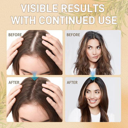 Rice Water Hair Growth Serum - Infused with Rosemary, Biotin, Caffeine, Non-Greasy Formula for Hair Loss, Damaged & Dry Hair, Thicker, Longer, Fuller Hair (3.38 OZ(Upgrade))