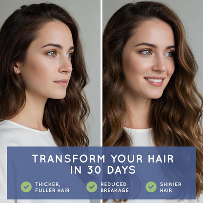 Biotin (Biotina Vitaminas) - Hair Skin Nails Vitamins for Women & Men - 5000 mcg - Hair Growth Support Supplements - 30 Tablets - with Revytalyz 5, Vitamin A, C, B12 - Made in USA