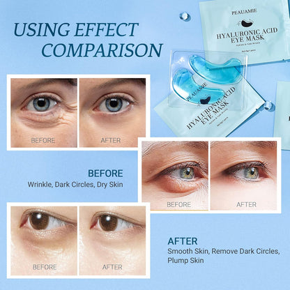 Under Eye Patchs Hyaluronic Acid Eye Mask for Dark Circles and Puffiness Wrinkle Eye Bags 30 Pairs