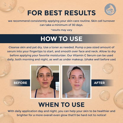 Vitamin C Face Serum 1oz – Stable Formula with Botanical Hyaluronic & Organic Jojoba for Dark Spots, Radiance, Hydration & Even Tone – Vegan Clean Beauty for Sensitive Skin, USA-Made