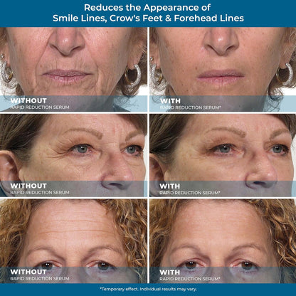 Plexaderm Rapid Reduction Eye Serum Pods - Advanced Formula - Anti Aging Serum Visibly Reduces Under Eye Bags, Wrinkles, Dark Circles, Fine Lines & Crow's Feet Instantly