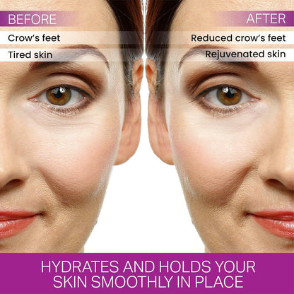 Furlesse Crows Wrinkle Patches, Overnight Eye Patches for Wrinkles and Crow’s Feet Lines, Non-invasive Anti-Wrinkle Patches, Anti-aging Skincare, 60 Patches, 30-Day Use